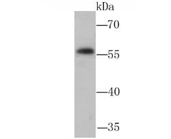 NFIB Antibody, Novus Biologicals 100 &mu;L | Buy Online | Novus Biologicals | Fisher Scientific